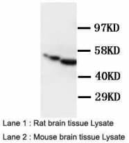 GFAP Antibody (C-Terminus)
