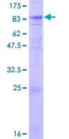 Human Cochlin / COCH Protein (Recombinant GST)
