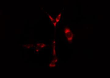 CYP1B1 Antibody