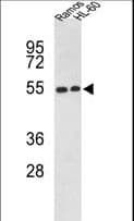 NR1H2 / LXR Beta Antibody (aa26-53)