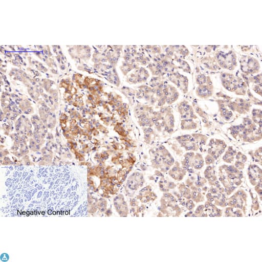 Collagen I Antibody