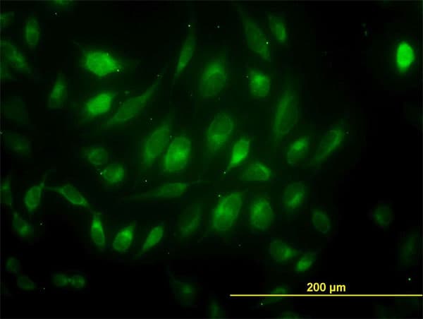 IHC-plus™ Monoclonal Mouse anti-Human USP33 / VDU1 Antibody (clone 5B5, IHC, IF, WB)