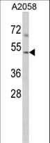 ACTR3 Antibody (aa380-407)