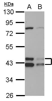 Polyclonal Rabbit anti-Human DNAJA3 / TID1 Antibody (IHC, IF, WB)