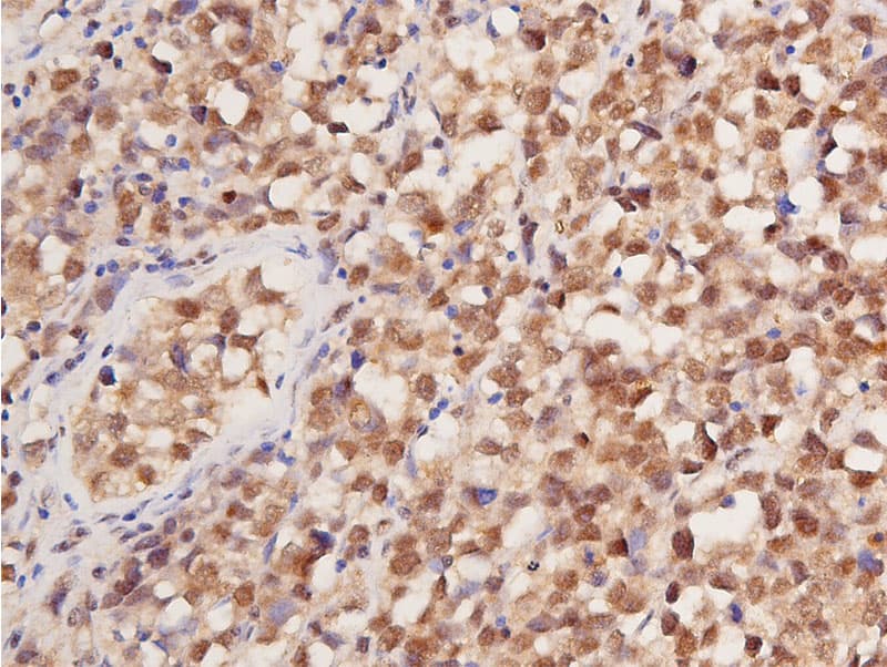 TP53 / p53 Antibody (phospho-Ser392)