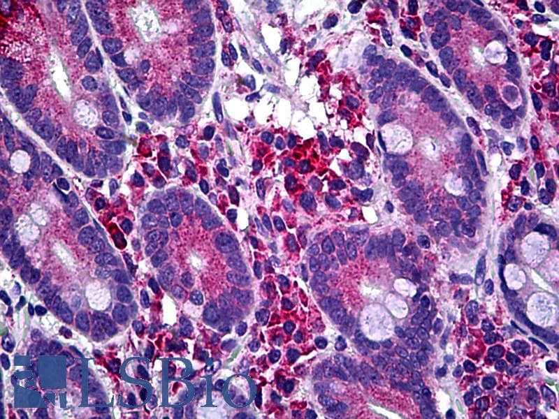 IHC-plus™ LIMK1 / LIMK Antibody (clone 1A8)