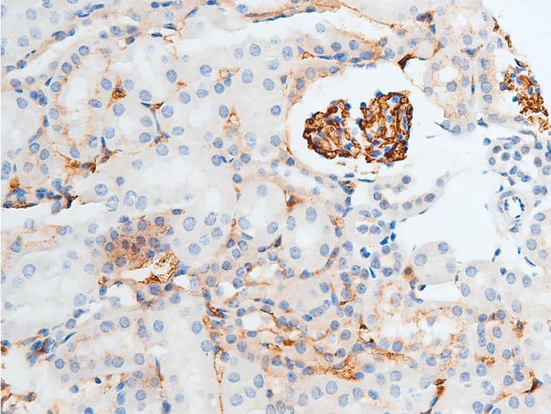 CHEK2 / CHK2 Antibody (phospho-Thr387)