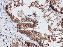 NUDT6 Antibody (clone OTI9D12)