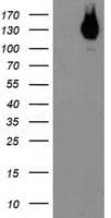 ERBB2 / HER2 Antibody (aa676-1255, clone OTI1D9, Carrier-free)