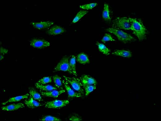 GJA8 / CX50 / Connexin 50 Antibody