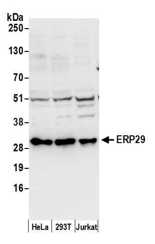 ERP29 Antibody (aa75-125)
