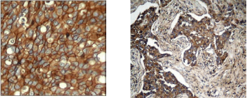 ERBB2 / HER2 Antibody
