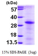Human LAT2 / NTAL Protein (Recombinant His)