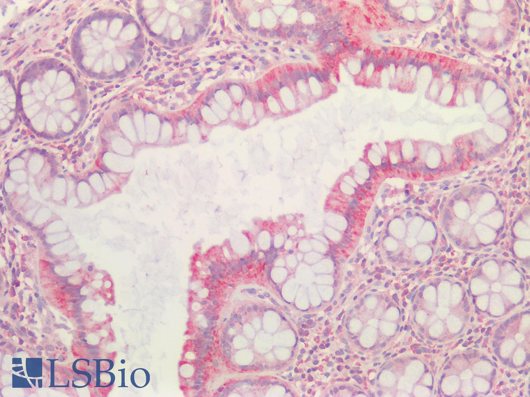 URAT1 / SLC22A12 Antibody