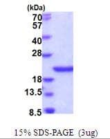 Human SCO1 Protein (Recombinant His)