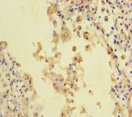 Polyclonal Rabbit anti-Human STIL Antibody (IHC, IF)