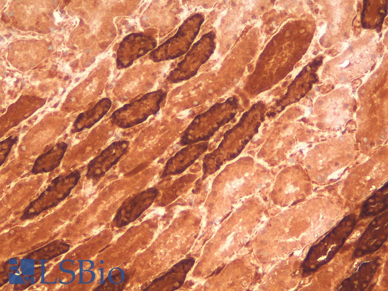 PathPlus™ Recombinant Monoclonal Mouse anti-Human CDH16 / Cadherin 16 Antibody (clone rCDH16/1071, IHC, WB)