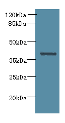 ARG2 / Arginase 2 Antibody