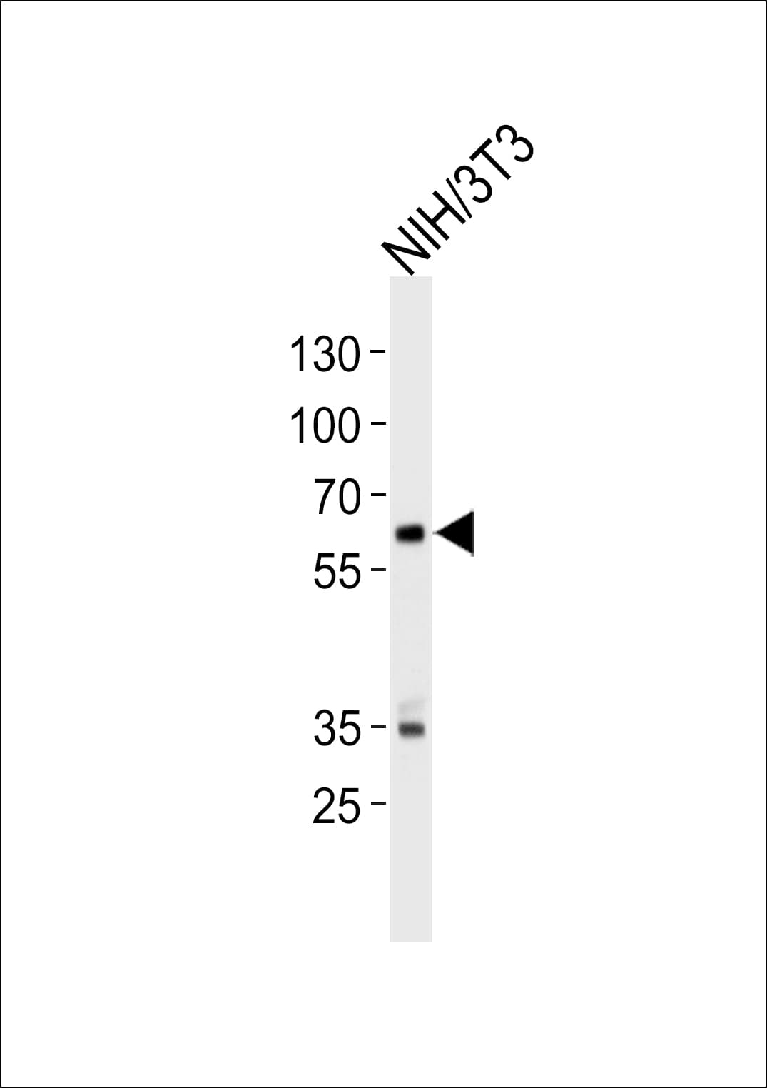 NTRK2 / TRKB Antibody (aa343-372)