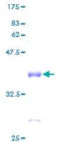 Human RPL37A Protein (Recombinant GST)