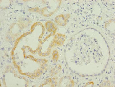 Polyclonal Rabbit anti-Human TMEM61 Antibody