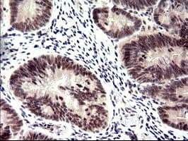 Monoclonal Mouse anti-Human PMS2 Antibody (clone OTI4B7, IHC, WB)