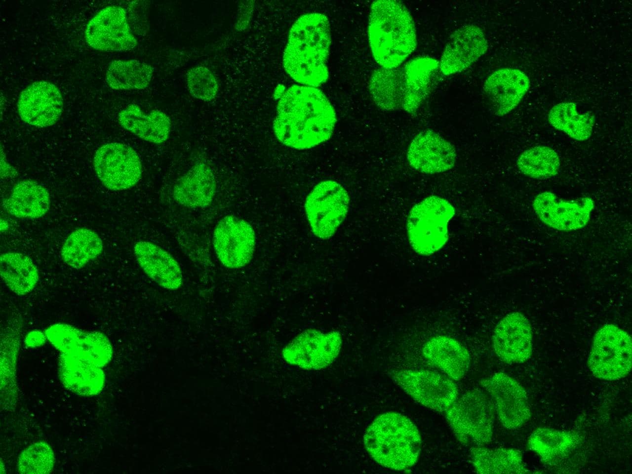 HNF1B / HNF1 Beta Antibody
