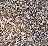 IFIX / PYHIN1 Antibody (aa26-55)