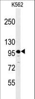IHC-plus™ PSK / SEZ6L2 Antibody (aa879-907)