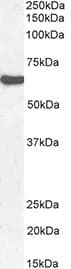 CFI / Complement Factor I Antibody