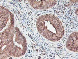 SERPINB6 / PI-6 Antibody (clone OTI2F8)