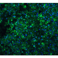 Polyclonal Rabbit anti-Human CIDEA / CIDE-A Antibody (IHC, IF, WB)