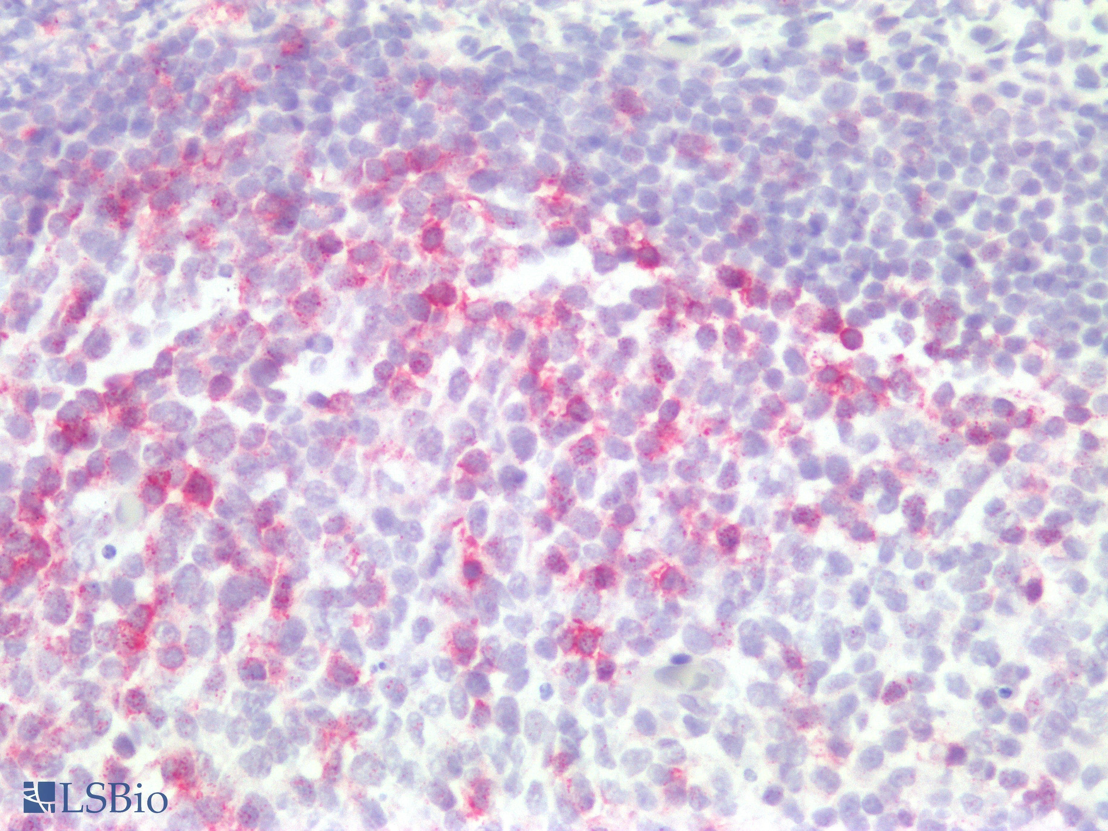PathPlus™ PDCD1 / CD279 / PD-1 Antibody (clone 3C6)