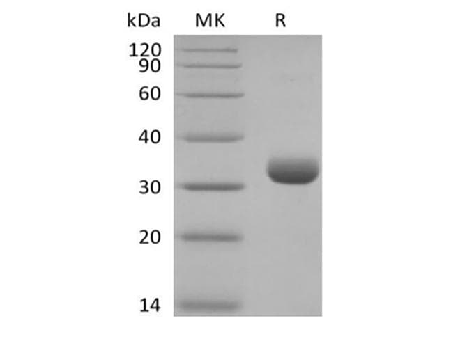 Human BTN3A2 Protein (Recombinant AVI-6His, C-terminus)