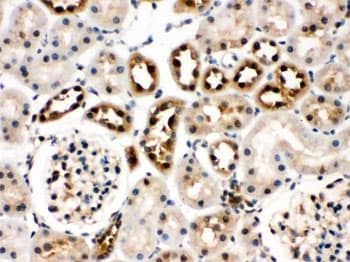 Polyclonal Rabbit anti-Human HSPA8 / HSC70 Antibody (IHC, WB)