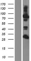 EPS8L2 Protein (Over-Expression Lysate Myc-DDK (Flag))
