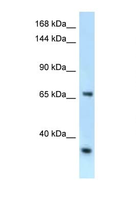 RBM15B Antibody (aa606-655)