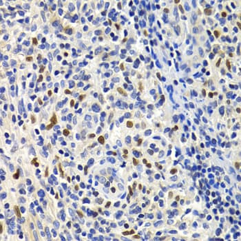 Polyclonal Rabbit anti-Human SIP1 Antibody (IHC, IF, WB)