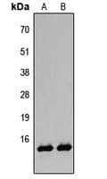 Histone H2B Antibody (Acetyl-Lys12)