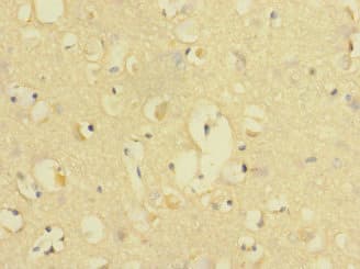 Polyclonal Rabbit anti-Human DNAM-1 / CD226 Antibody (IHC, WB)