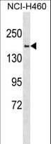 Polyclonal Rabbit anti-Human SYNJ2 / Synaptojanin 2 Antibody (aa679-707, WB)