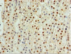 Polyclonal Rabbit anti-Human CENPQ Antibody (aa131-268, IHC)