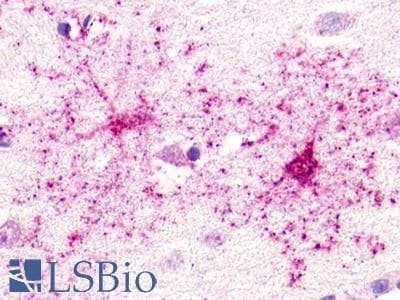 PathPlus™ GPR52 Antibody (N-Terminus)