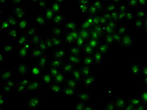 UBE2R2 Antibody