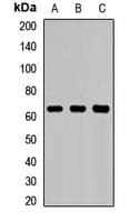 SLC22A5 / OCTN2 Antibody