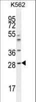 APCS / Serum Amyloid P / SAP Antibody (aa151-178)