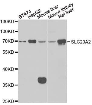 SLC20A2 / PIT2 Antibody