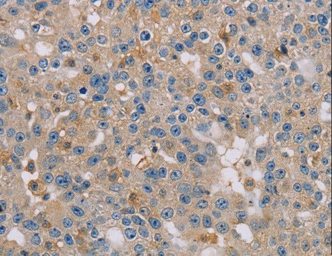CLIC1 / NCC27 Antibody
