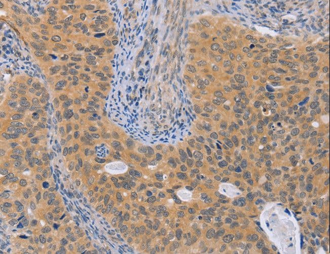 BRS3 Antibody