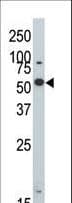 DYRK2 Antibody (aa105-135)